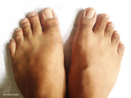 Kaki lebar