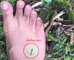 darah karena lintah