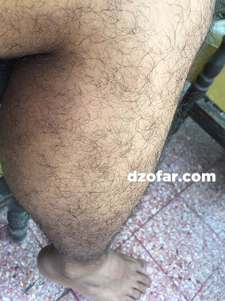 Bulu kaki